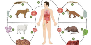 Эхинококкоз-қатерлі дерт